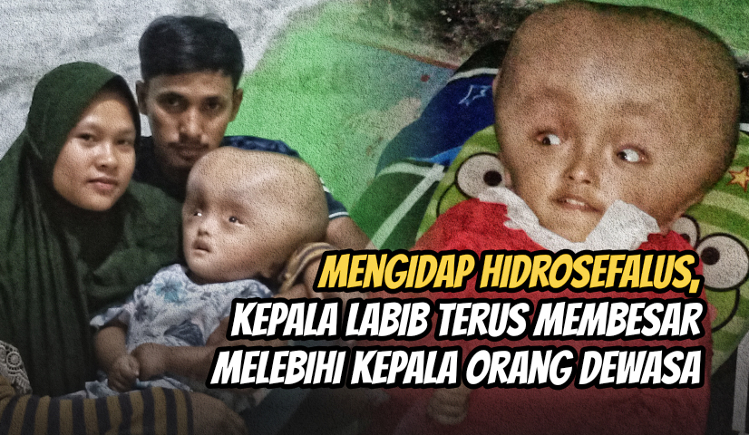 Bantu Pengobatan Anak Penjual Cilok Keliling Idap 3 Penyakit Sekaligus
