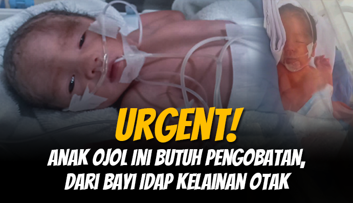 Idap Kelainan Otak, Bantu Anak Ojol Ini Bisa Lakukan Pengobatan