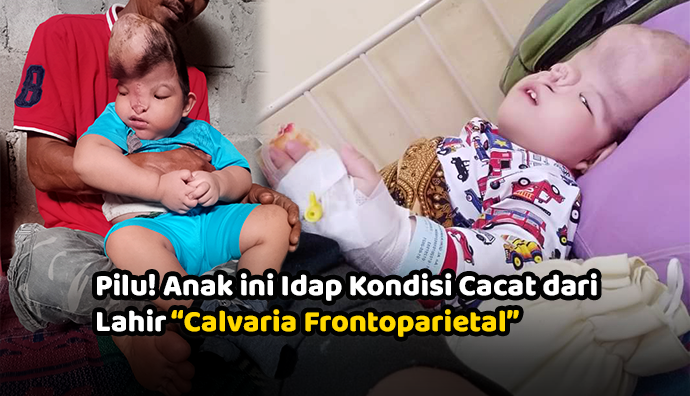 Urgent! Idap Kelainan Sejak Lahir, Bantu Anak 2 Tahun Ini Bisa Sembuh!