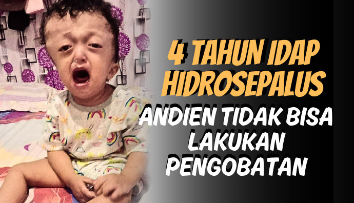 Idap Hidrosefalus Sejak Lahir, Bantu Andien Bisa Lakukan Pengobatan