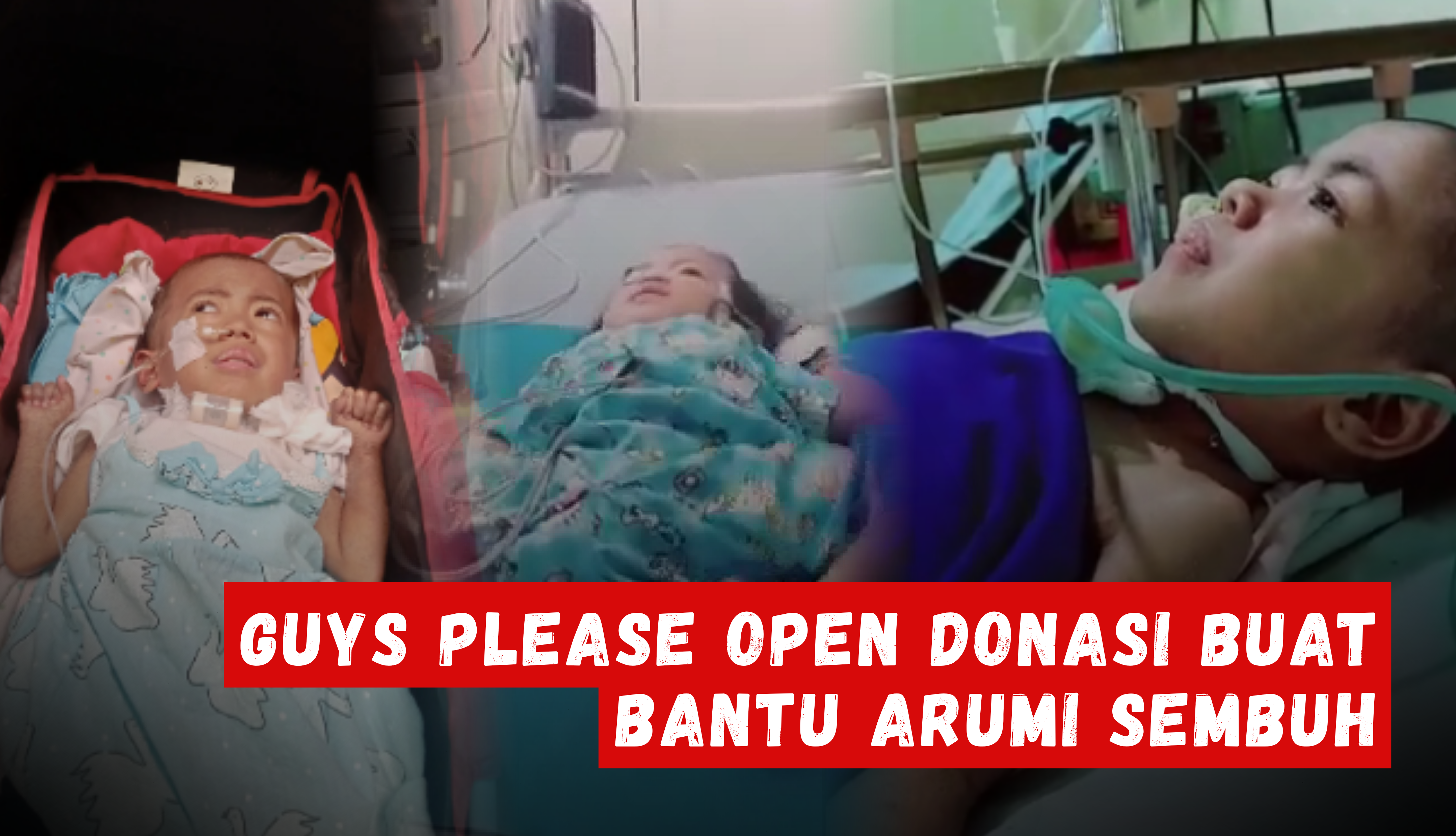 Idap 2 Penyakit Sekaligus, Bantu Arumi Bisa Sembuh