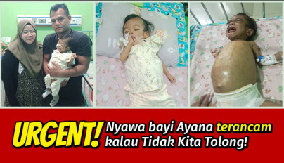 Idap 2 Penyakit Sekaligus, Bantu Bayi 10 Bulan Ini Sembuh