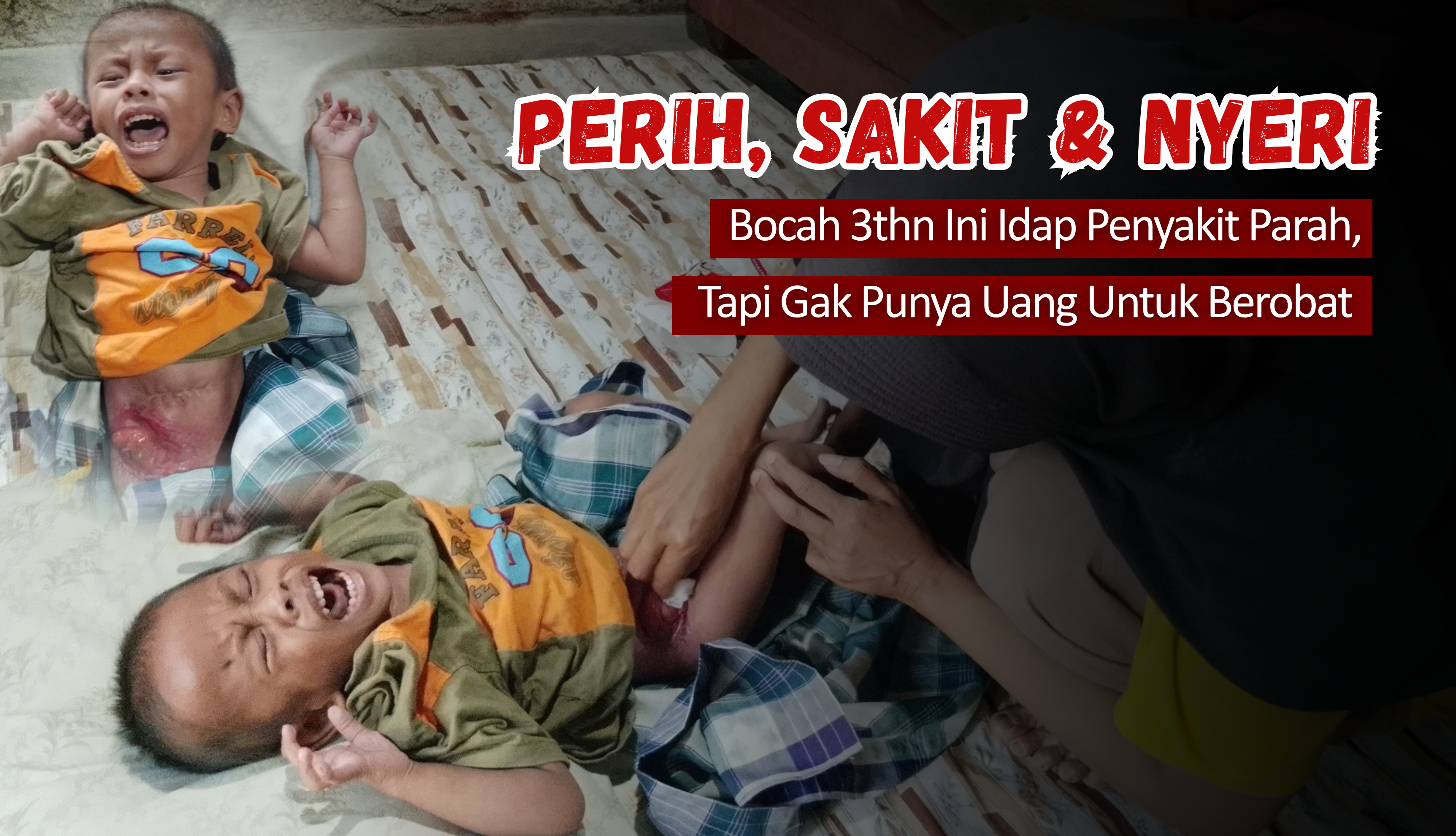 Lahir Tanpa Anus, Bantu Anak Ojol Ini Bisa Lakukan Pengobatan