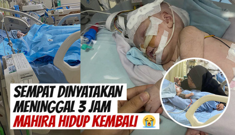 Ditelantarkan Ayah, Bayi Hidrosefalus Ini Butuh Pengobatan Segera
