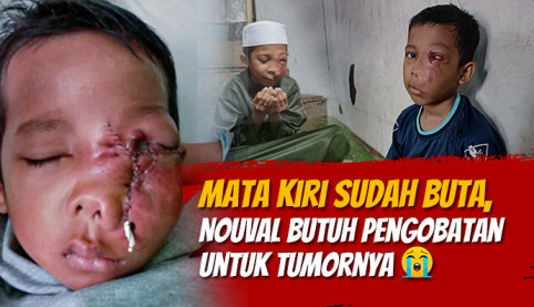 Idap Tumor di Wajah, Bantu Nouval Bisa Berobat