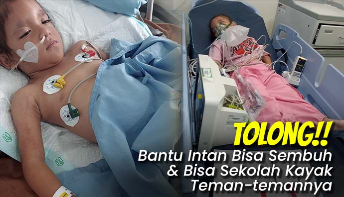 Intan 6 Tahun Kritis! Berjuang Lawan Kelainan Jantung & Epilepsi!