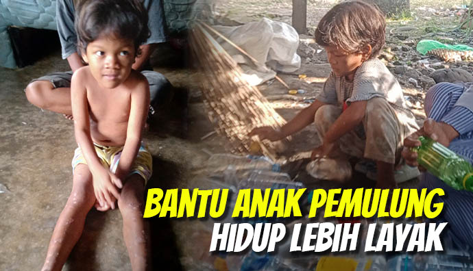 Bantu Anak Pemulung Ini Sembuh dan Hidup Layak
