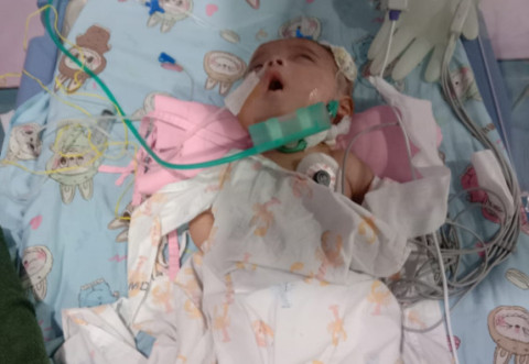 Terbaring Lemah, Bantu Bayi 3 Bulan Ini Sembuh