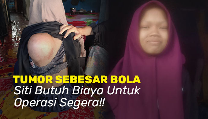 Sejak Umur 4Tahun, Siti Idap Tumor di Punggung