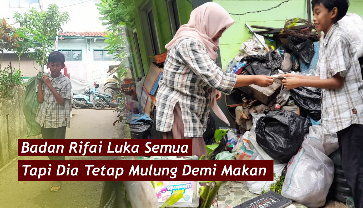 Idap Penyakit Kulit, Anak Terlantar Pencari Rongsok Hidupi Ayah Sakit