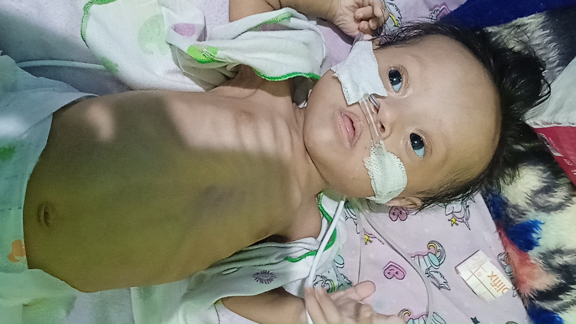 Idap Gangguan Pernapasan, Abhizar Butuh Bantuan Segera