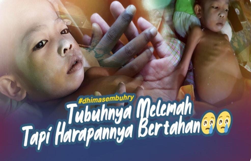 4 Tahun Idap Penyakit Liver, Bantu Dimas Bisa Sembuh