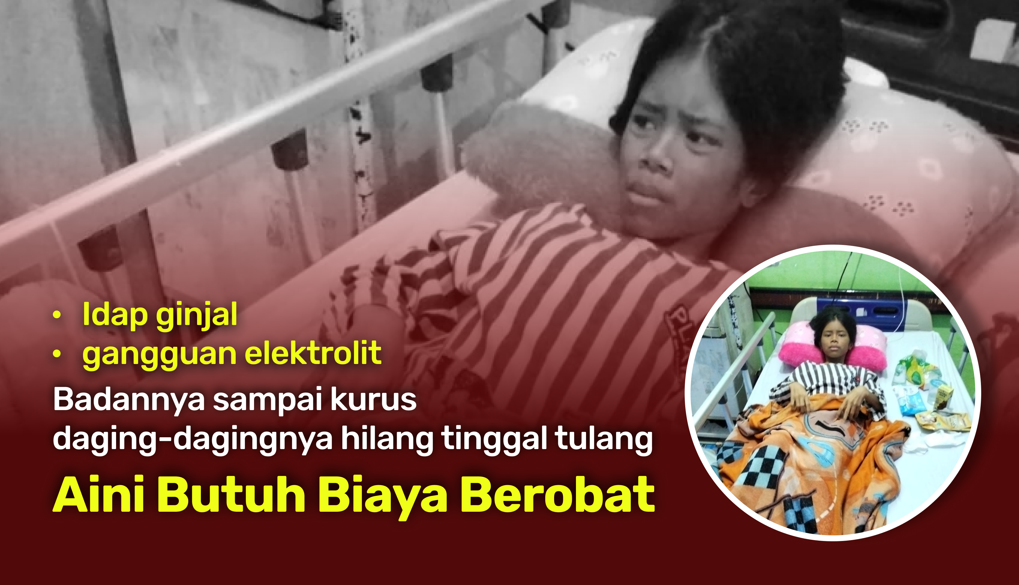 Berjuang Melawan Penyakit Ginjal, Aini Ingin Kembali Sekolah