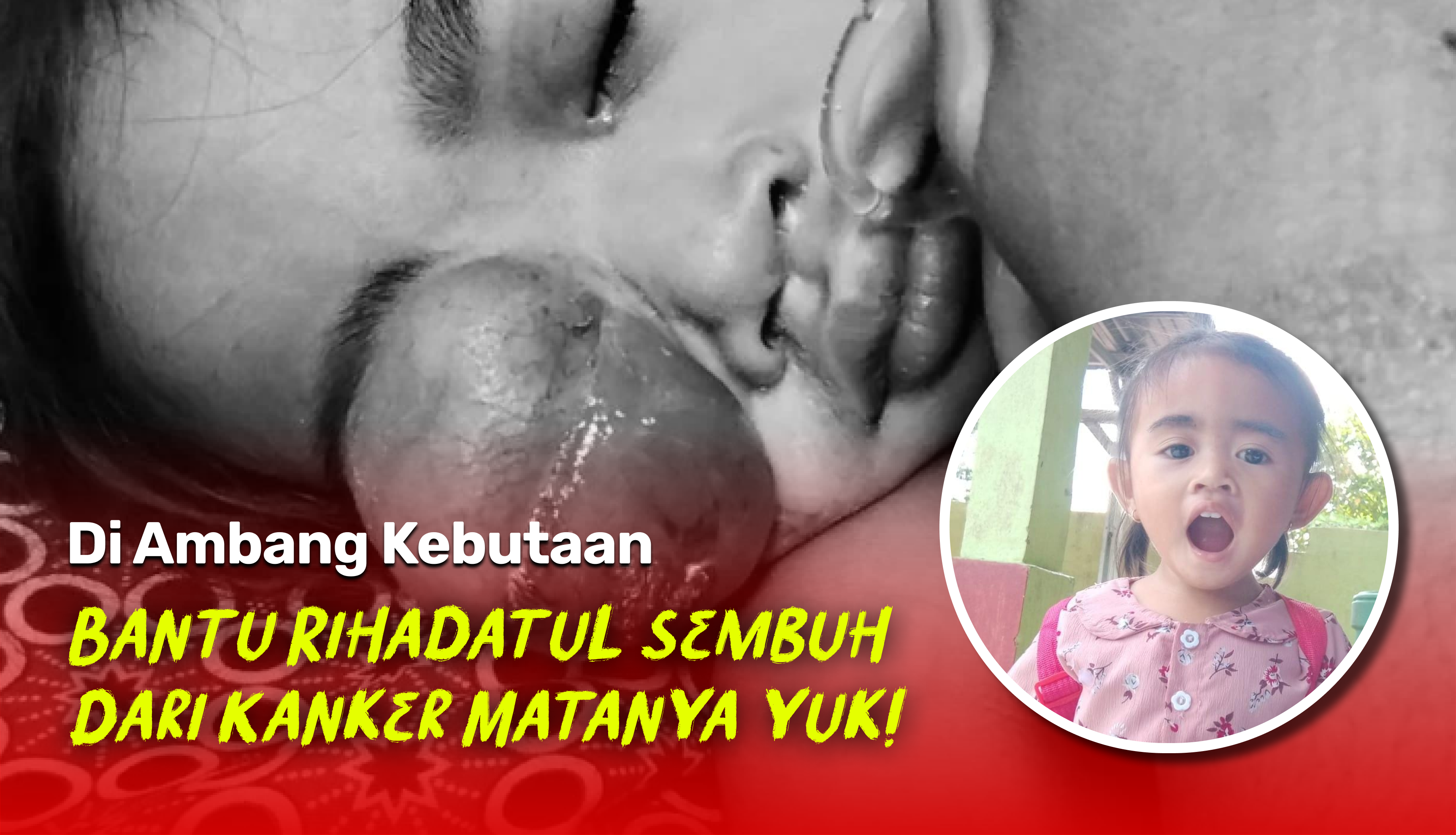 Benjolan Semakin Membesar, Bantu Rihadatul Bisa Sembuh