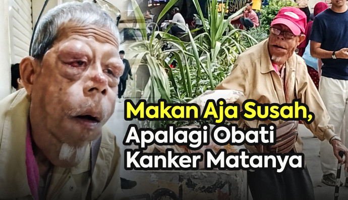 Jarang Laku! Penjual Kerupuk Ini Idap Kanker Mata