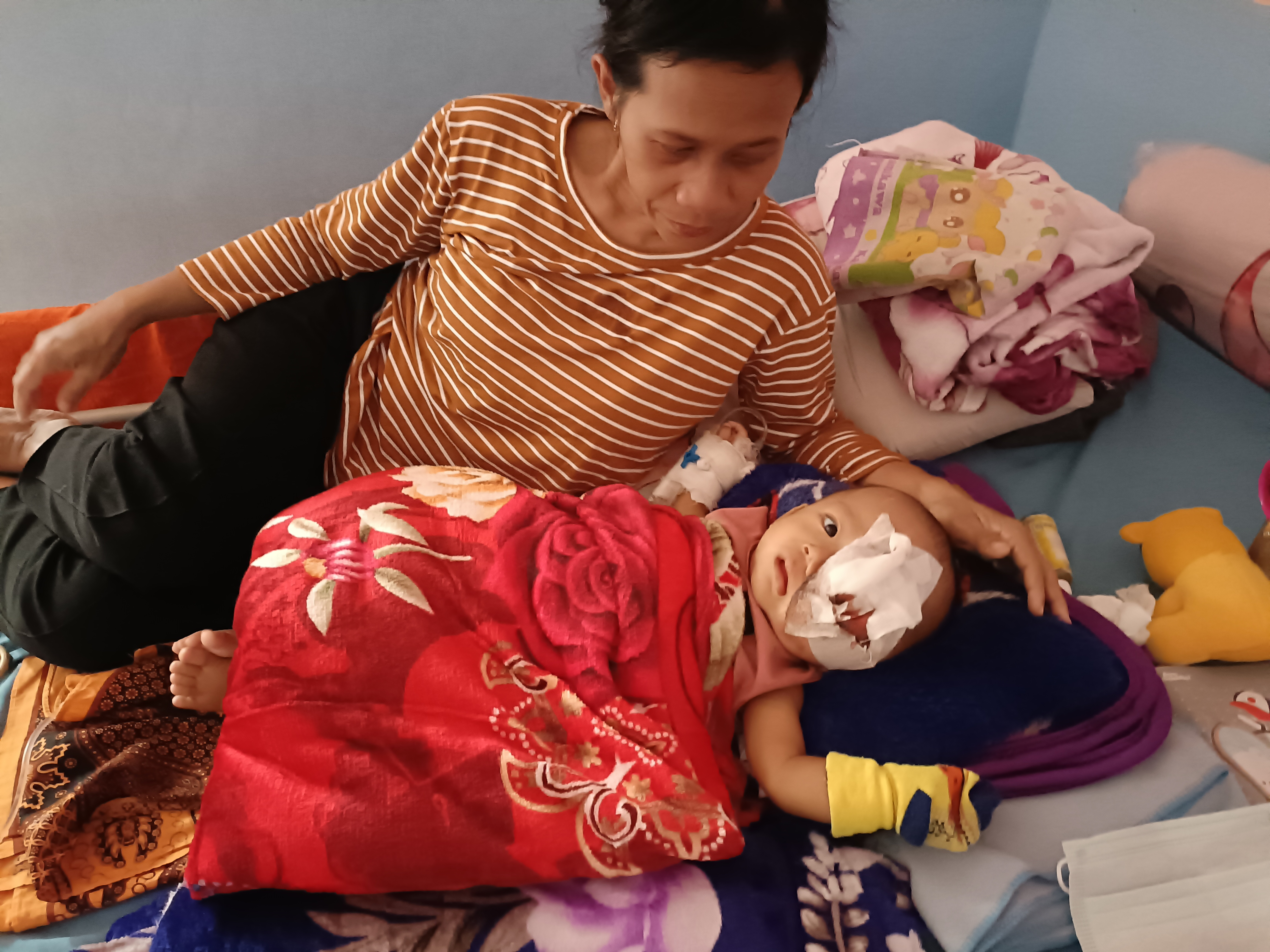 Bantu Bayi 7 Bulan Ini Idap Tumor Ganas di Matanya