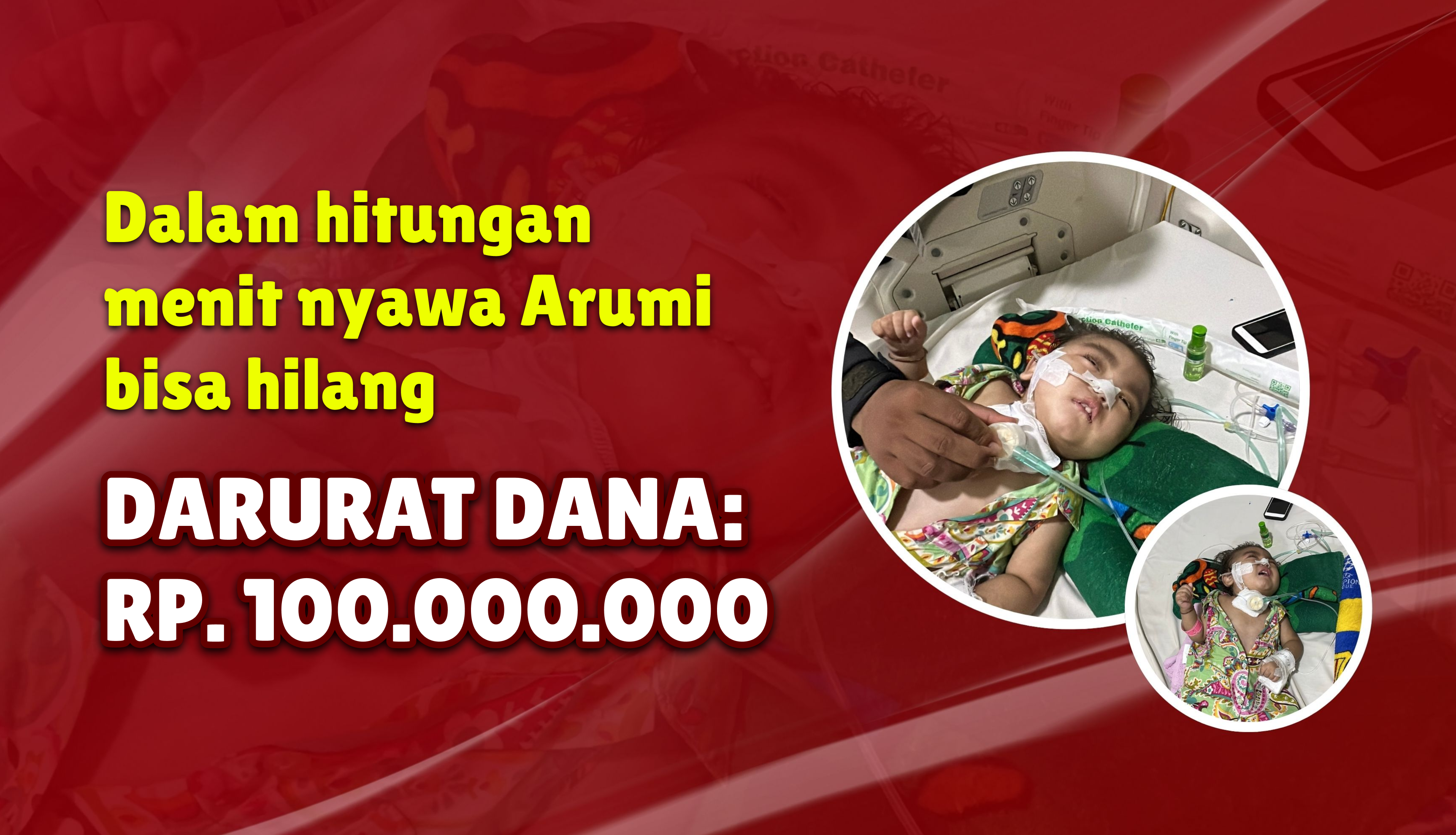 Darurat: Bayi Arumi Butuh Alat Penyedot Dahak dan Oksigen Tiap 12 Jam