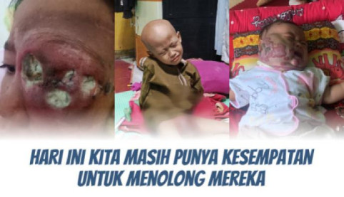 Butuh Biaya Besar ! Bantu Yatim Dhuafa Bisa Berobat