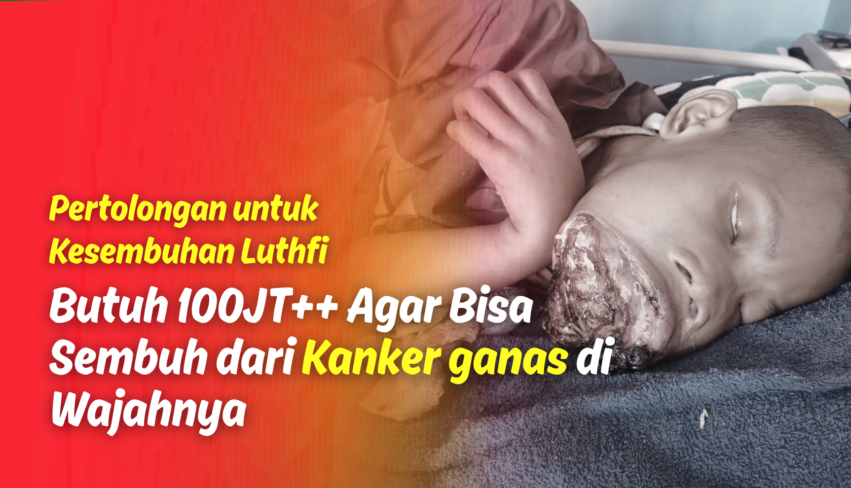 Benjolan Semakin Membesar ! Bantu Yatim Ini Sembuh