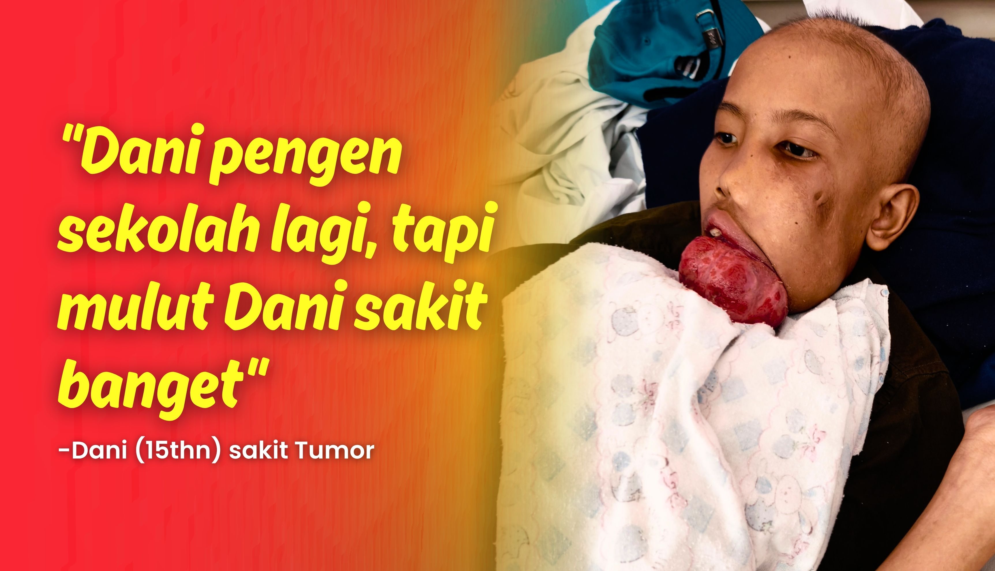 Tumor Membesar! Dani Kesulitan Makan dan Berbicara