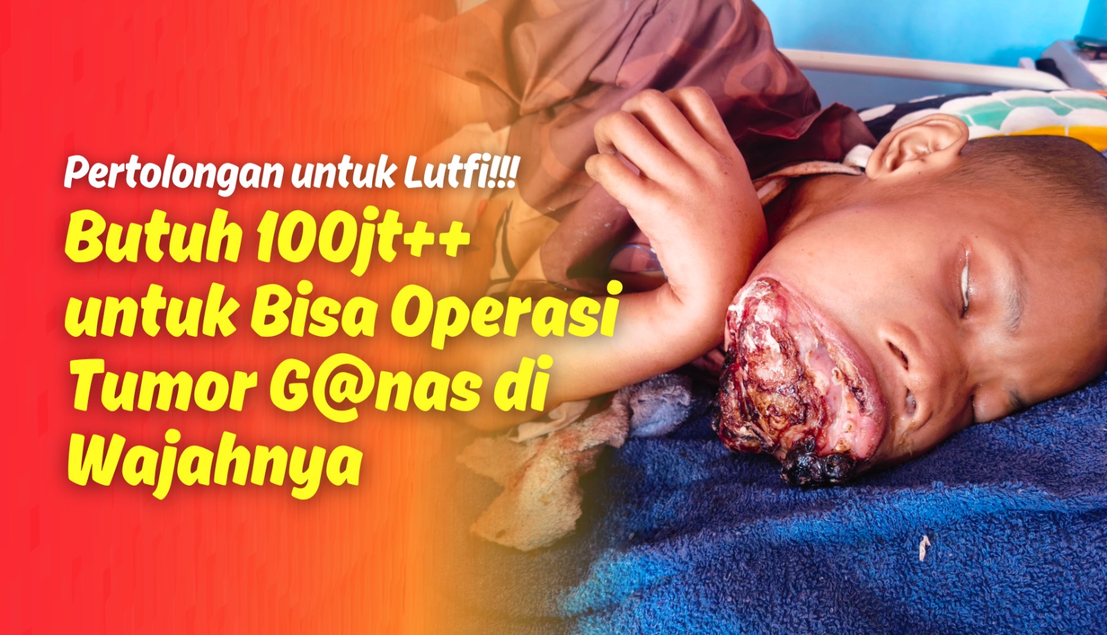 Tumor Ganas Semakin Parah! Bantu Yatim Ini Bisa Operasi