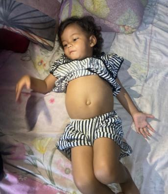 Di Usia 3 Tahun, Ade Anandiya Harus Bolak-Balik Rumah Sakit Demi Bertahan