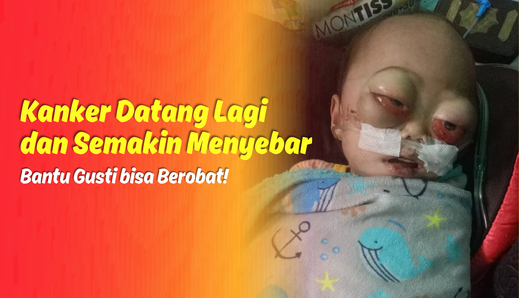 Bantu Ibu Penjual Gorengan Ini Tuk Anak Idap Kanker Darah