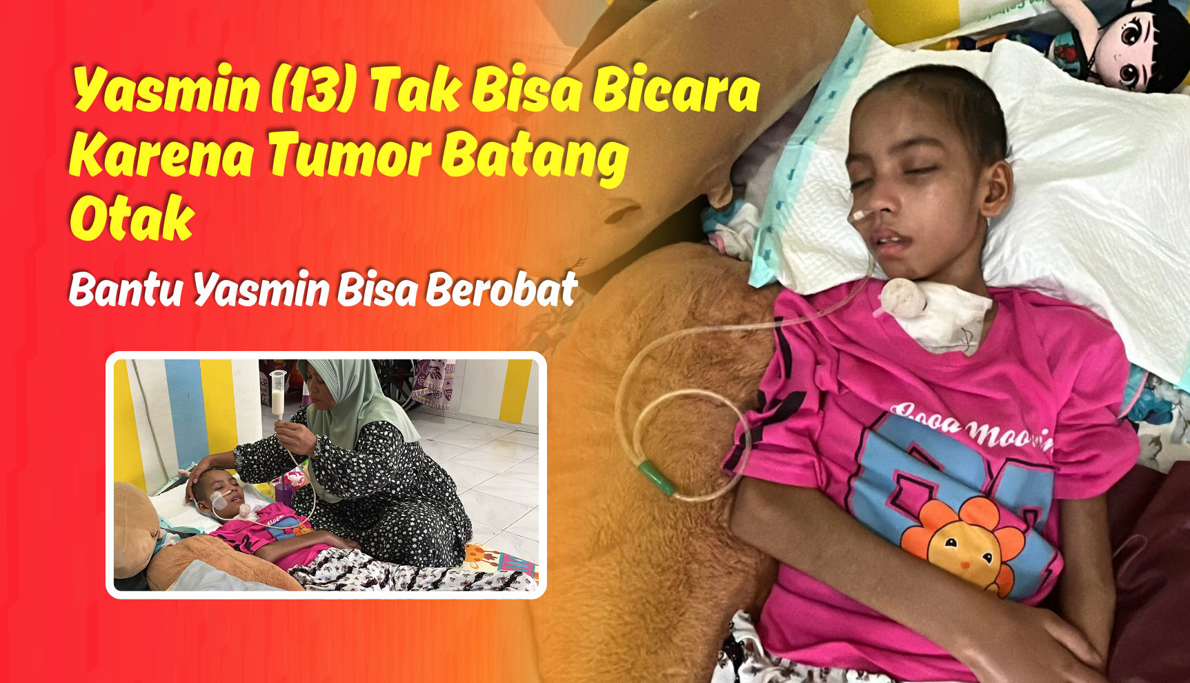 Idap Tumor Batang Otak, Yasmin Butuh Pengobatan