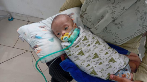 Baru 9 Bulan, Rafasha Butuh Alat Medis Demi Bernapas