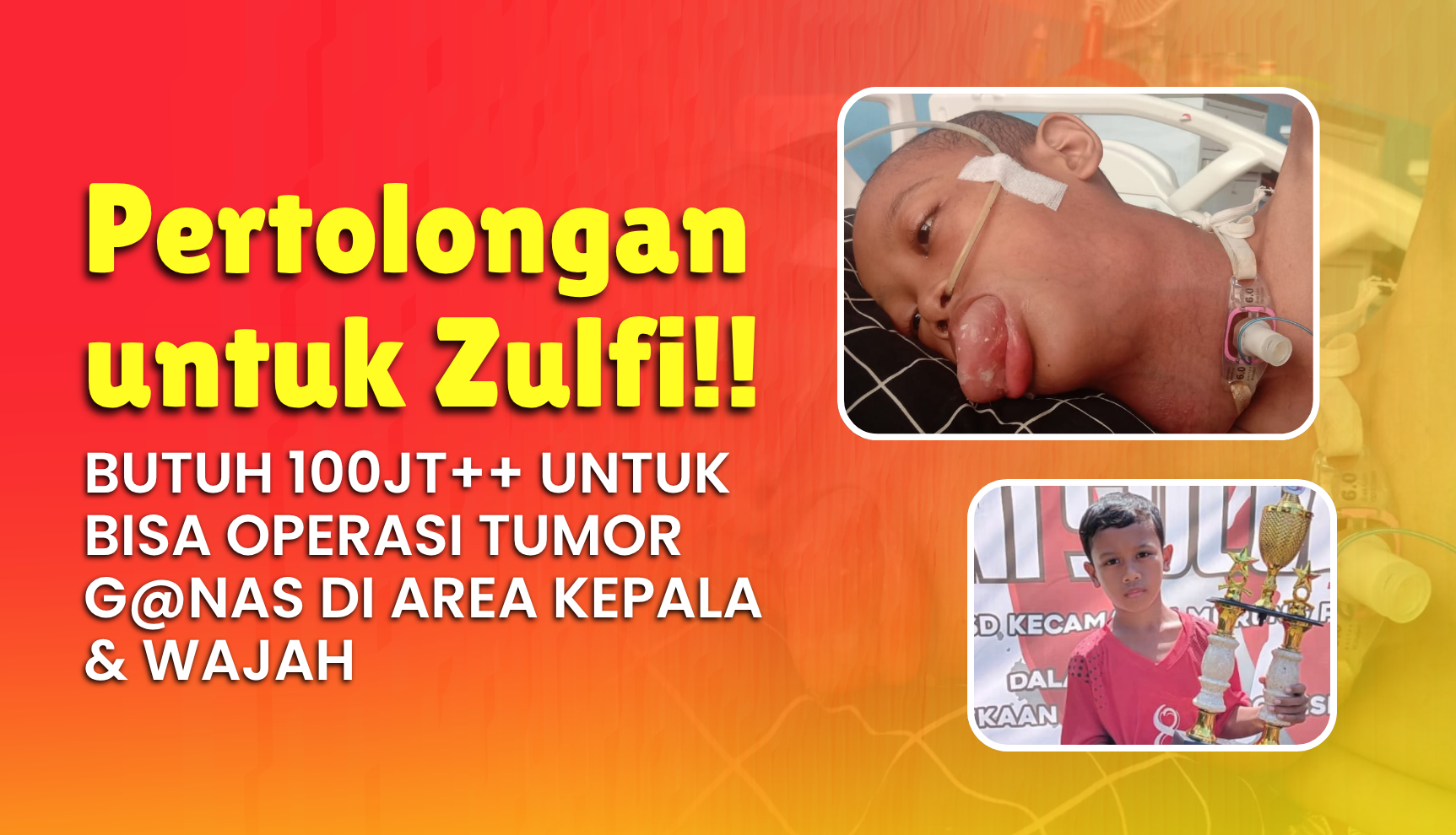 Sering Juara, Bantu Zulfi Melawan Tumor di Leher
