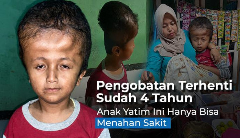 Bantu Yatim (11) Idap Hidrosefalus Bisa Operasi