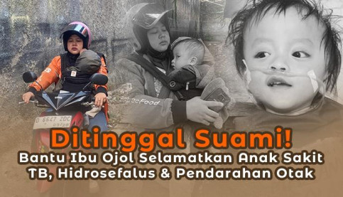 Saudara Kembarnya Meninggal, Bantu Gizan (2) Berjuang Sembuh