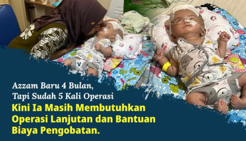 Sering Kejang, Bayi Hidrosefalus Ini Butuh Operasi Segera